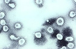 Transmission electron micrograph of coronavirus OC43 virions